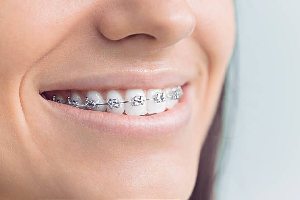Best Teeth Whitening  in Orangeburg, SC